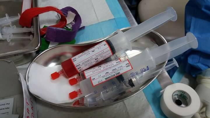 Bermula Ketulan Sebesar Guli & Rasa Sengal Pada Lengan 